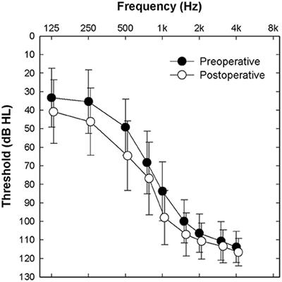 Intracochlear Recordings of Acoustically and Electrically Evoked Potentials in Nucleus Hybrid L24 Cochlear Implant Users and Their Relationship to Speech Perception
